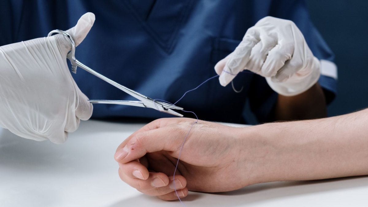 FDA อนุมัติแมลงวันกินซากตัวที่สองสำหรับการบำบัดแผลด้วยหนอน
