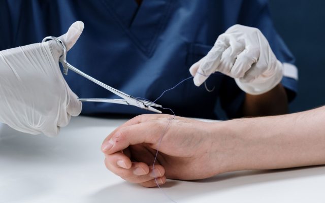 FDA อนุมัติแมลงวันกินซากตัวที่สองสำหรับการบำบัดแผลด้วยหนอน